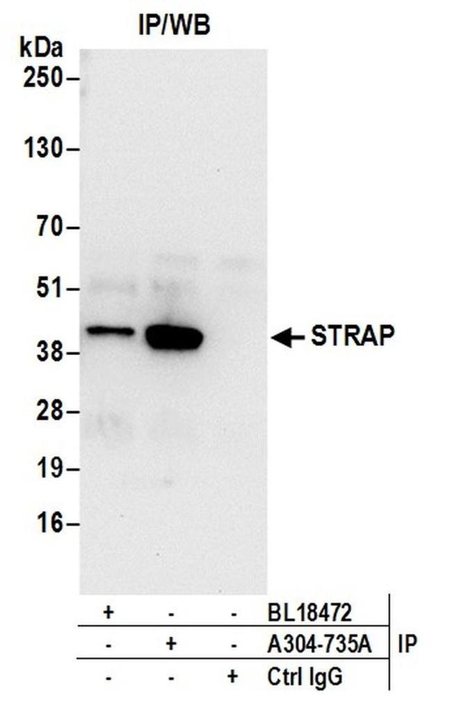 STRAP Antibody in Western Blot (WB)