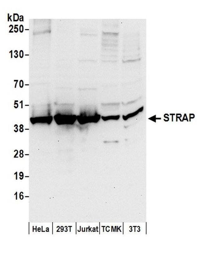 STRAP Antibody in Western Blot (WB)