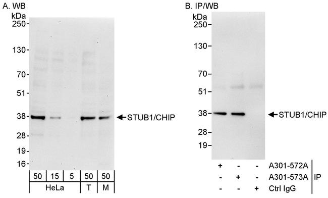 STUB1/CHIP Antibody in Western Blot (WB)