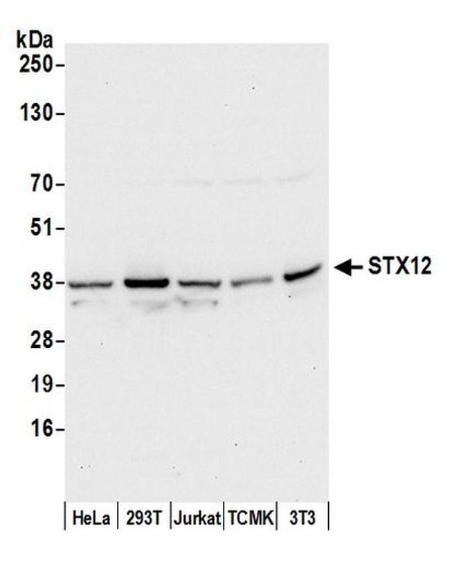 STX12 Antibody in Western Blot (WB)