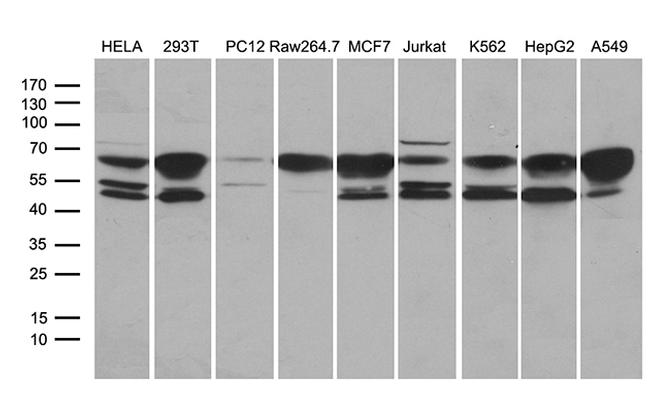 STX18 Antibody in Western Blot (WB)