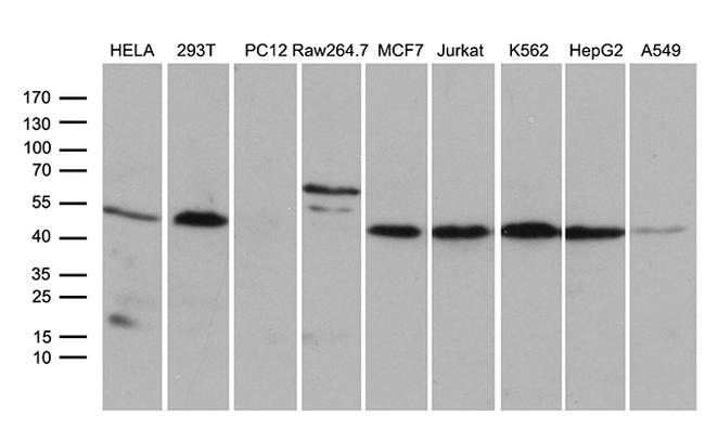 STX18 Antibody in Western Blot (WB)