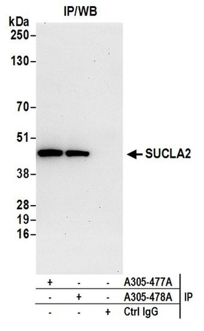 SUCLA2 Antibody in Western Blot (WB)