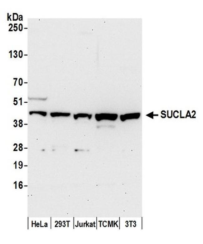 SUCLA2 Antibody in Western Blot (WB)