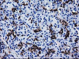 SULT1A1 Antibody in Immunohistochemistry (Paraffin) (IHC (P))