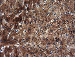 SULT1A1 Antibody in Immunohistochemistry (Paraffin) (IHC (P))