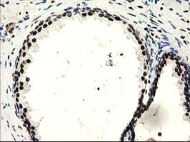 SULT1A1 Antibody in Immunohistochemistry (Paraffin) (IHC (P))