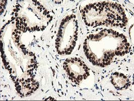 SULT1A1 Antibody in Immunohistochemistry (Paraffin) (IHC (P))