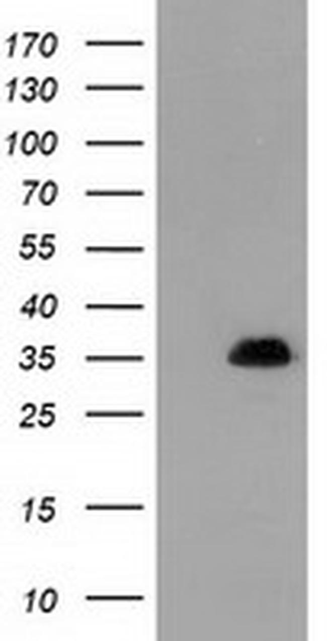 SULT1A1 Antibody in Western Blot (WB)