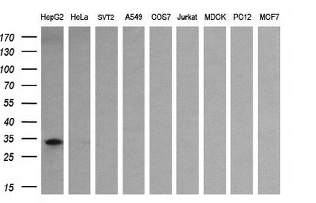 SULT1A1 Antibody in Western Blot (WB)