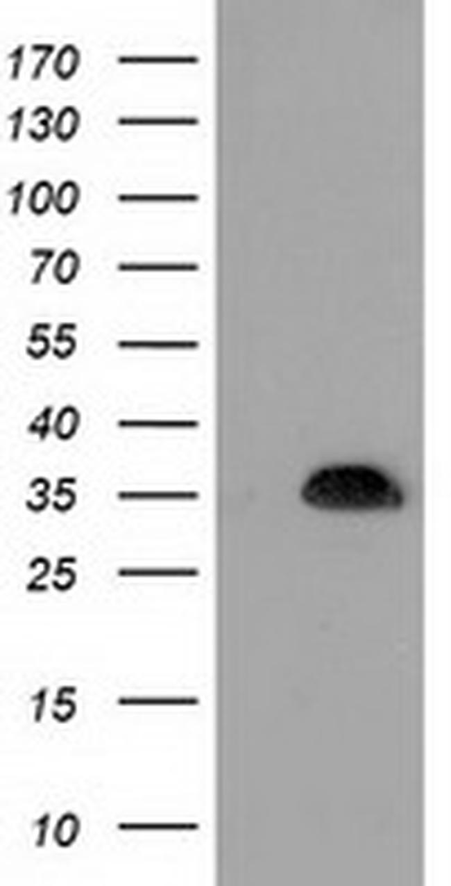 SULT1A1 Antibody in Western Blot (WB)