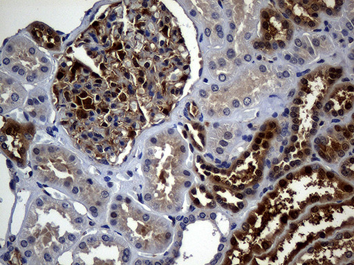 SULT1A3 Antibody in Immunohistochemistry (Paraffin) (IHC (P))