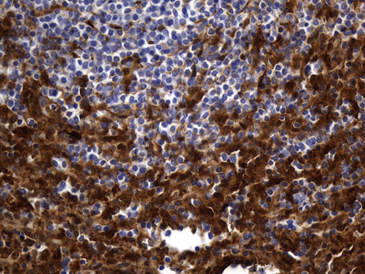 SULT1A3 Antibody in Immunohistochemistry (Paraffin) (IHC (P))