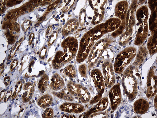 SULT1A3 Antibody in Immunohistochemistry (Paraffin) (IHC (P))