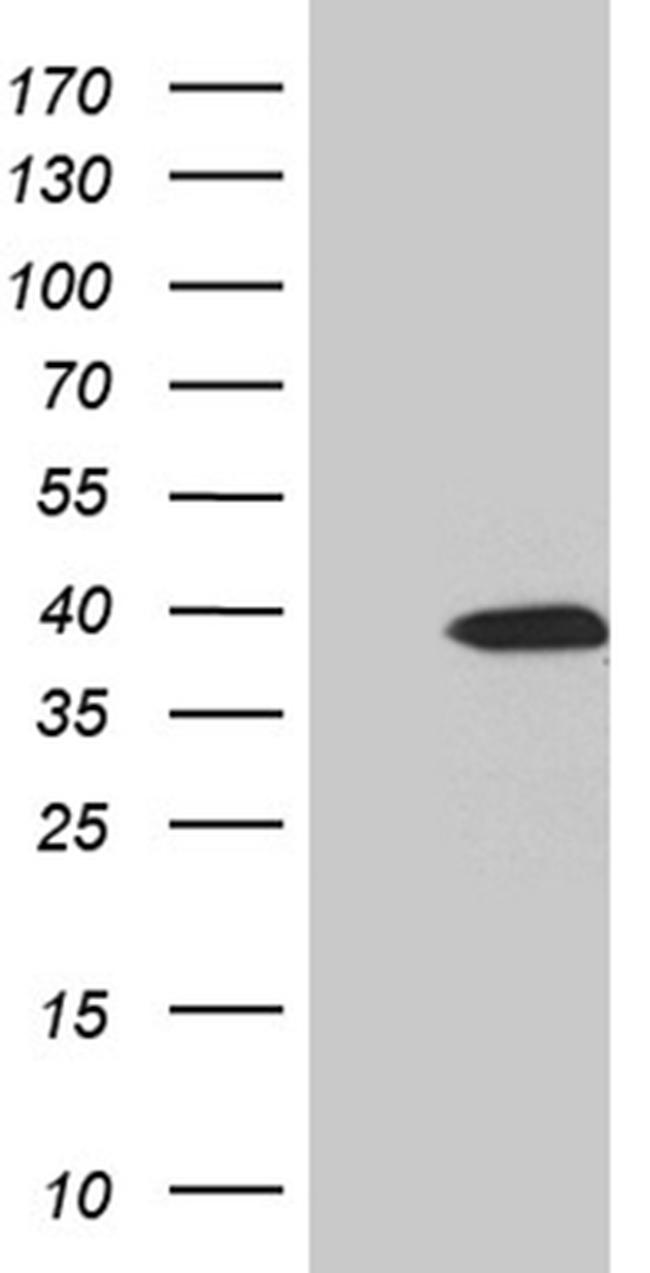 SULT1A3 Antibody in Western Blot (WB)