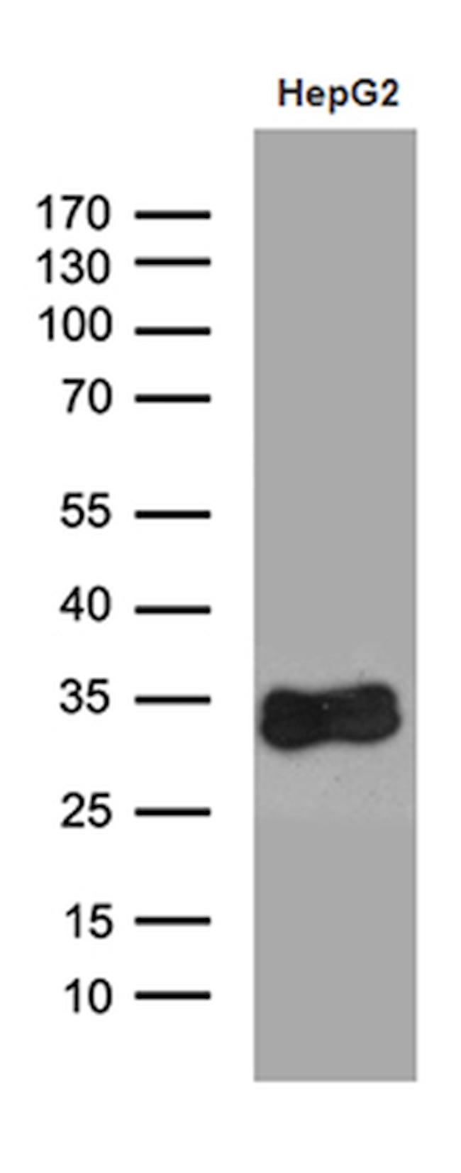 SULT1A3 Antibody in Western Blot (WB)