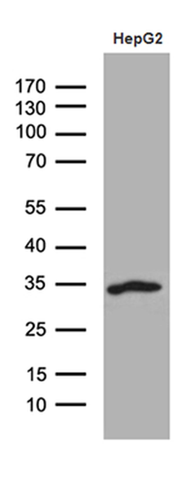 SULT1A3 Antibody in Western Blot (WB)