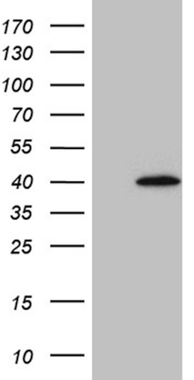 SULT1A3 Antibody in Western Blot (WB)