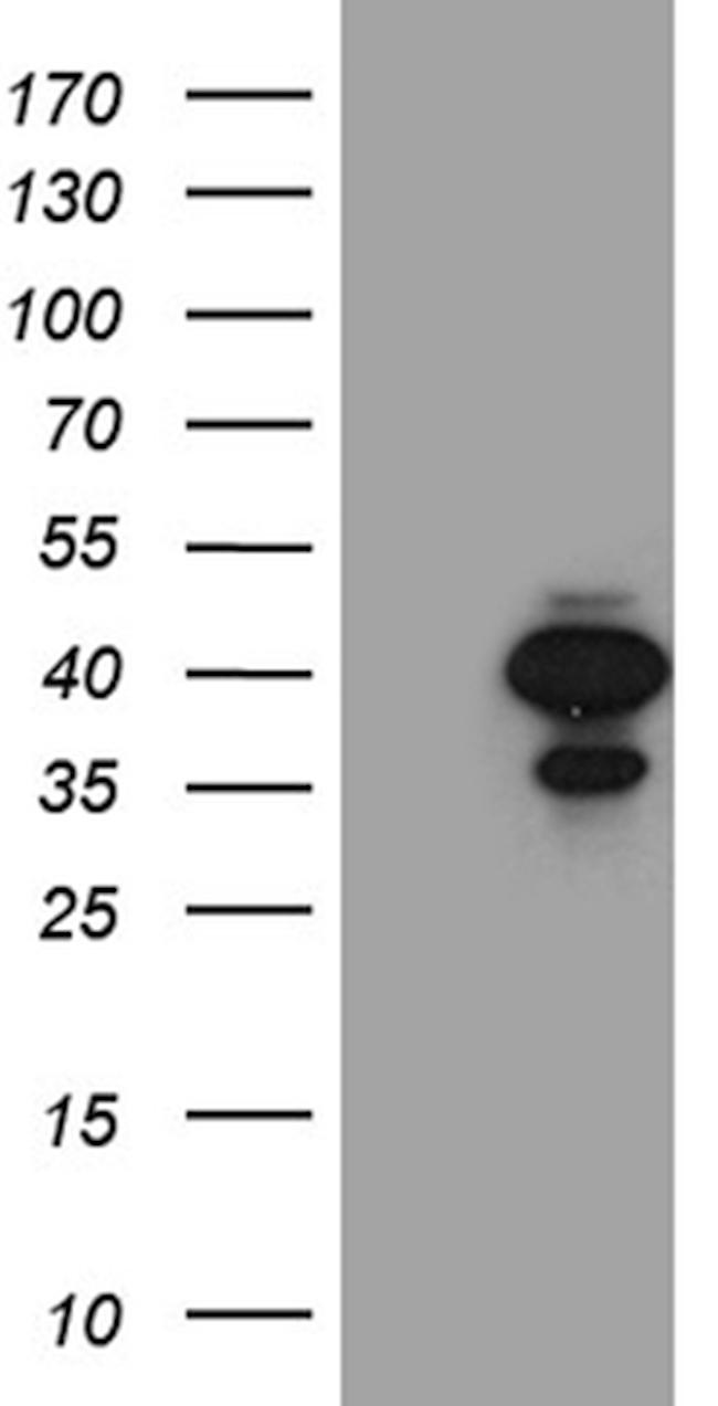 SULT1A3 Antibody in Western Blot (WB)