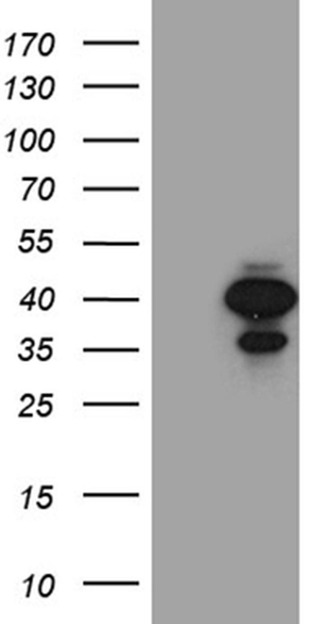 SULT1A3 Antibody in Western Blot (WB)