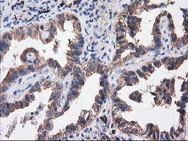 SULT1C2 Antibody in Immunohistochemistry (Paraffin) (IHC (P))