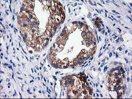 SULT1C2 Antibody in Immunohistochemistry (Paraffin) (IHC (P))