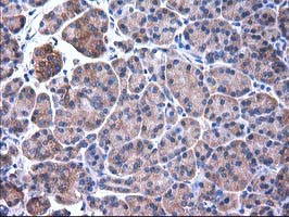 SULT1C2 Antibody in Immunohistochemistry (Paraffin) (IHC (P))