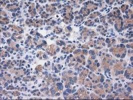 SULT1C2 Antibody in Immunohistochemistry (Paraffin) (IHC (P))