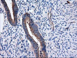 SULT1C2 Antibody in Immunohistochemistry (Paraffin) (IHC (P))