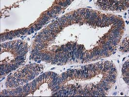 SULT1C2 Antibody in Immunohistochemistry (Paraffin) (IHC (P))