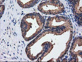 SULT1C2 Antibody in Immunohistochemistry (Paraffin) (IHC (P))