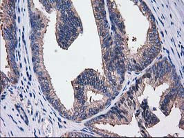 SULT1C2 Antibody in Immunohistochemistry (Paraffin) (IHC (P))