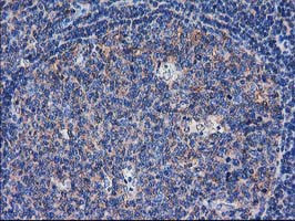 SULT1C2 Antibody in Immunohistochemistry (Paraffin) (IHC (P))