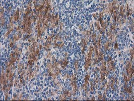 SULT1C2 Antibody in Immunohistochemistry (Paraffin) (IHC (P))