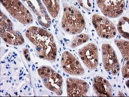 SULT1C2 Antibody in Immunohistochemistry (Paraffin) (IHC (P))