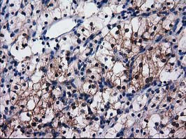 SULT1C2 Antibody in Immunohistochemistry (Paraffin) (IHC (P))