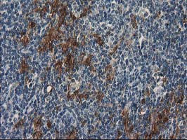 SULT1C2 Antibody in Immunohistochemistry (Paraffin) (IHC (P))