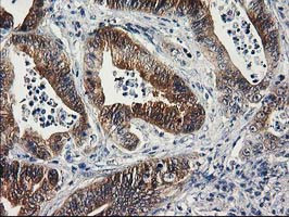 SULT1C2 Antibody in Immunohistochemistry (Paraffin) (IHC (P))