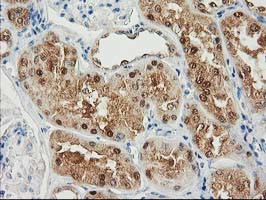 SULT1C2 Antibody in Immunohistochemistry (Paraffin) (IHC (P))