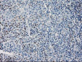 SULT1C2 Antibody in Immunohistochemistry (Paraffin) (IHC (P))