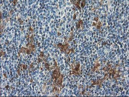 SULT1C2 Antibody in Immunohistochemistry (Paraffin) (IHC (P))