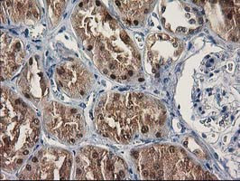 SULT1C2 Antibody in Immunohistochemistry (Paraffin) (IHC (P))