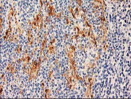 SULT1C2 Antibody in Immunohistochemistry (Paraffin) (IHC (P))