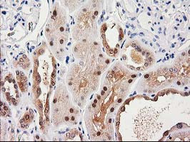 SULT1C2 Antibody in Immunohistochemistry (Paraffin) (IHC (P))