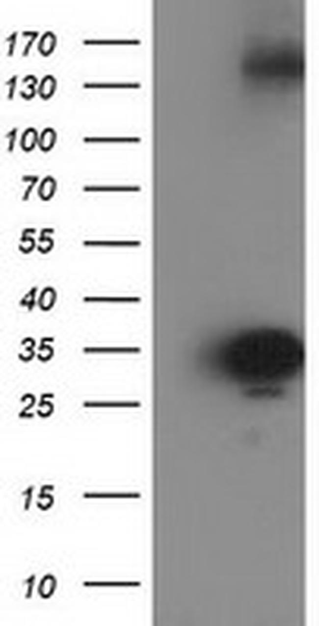 SULT1C2 Antibody in Western Blot (WB)