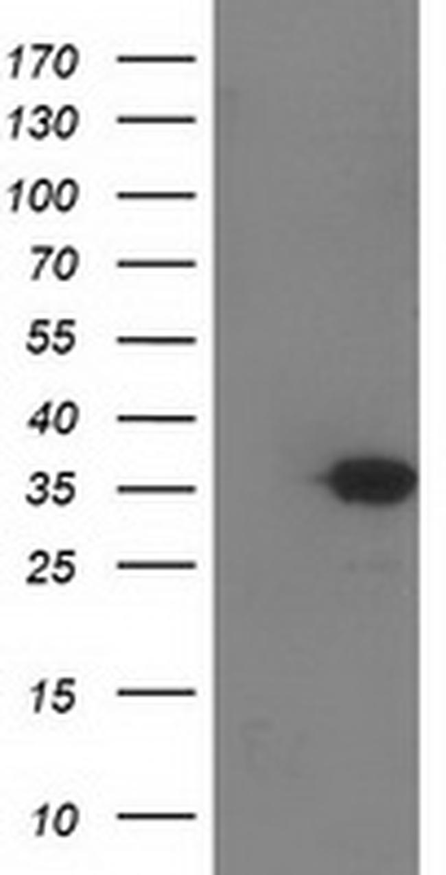 SULT1C2 Antibody in Western Blot (WB)