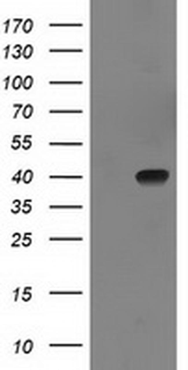 SULT1C2 Antibody in Western Blot (WB)