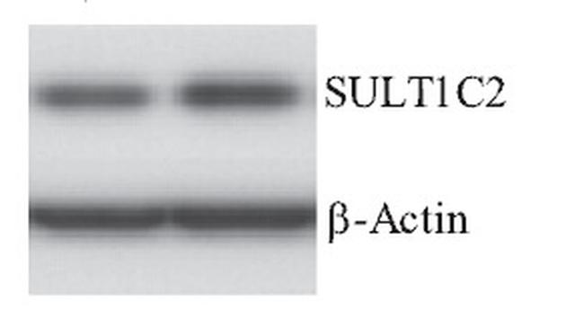 SULT1C2 Antibody in Western Blot (WB)