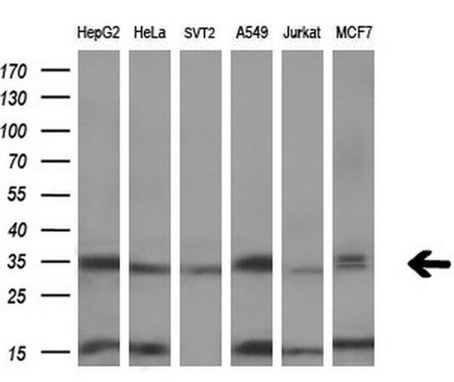 SULT1C2 Antibody in Western Blot (WB)