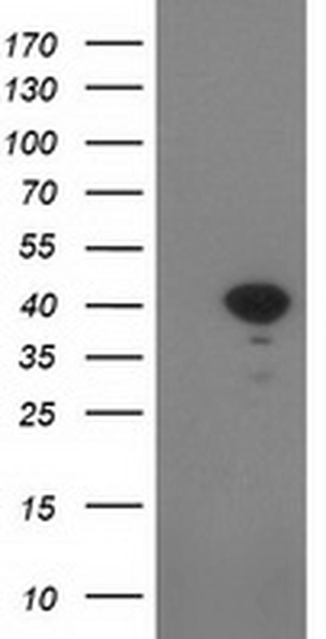 SULT1C2 Antibody in Western Blot (WB)